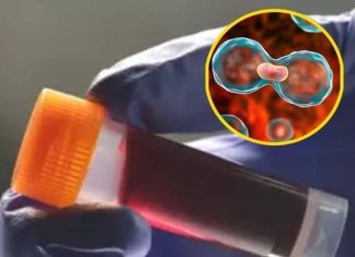 Understanding the Link Between Your Blood Type and Health