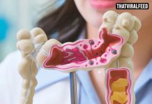 Scientists Explain Why Colon Cancer Is The Only Cancer With Rising Death Rates In People Under 50