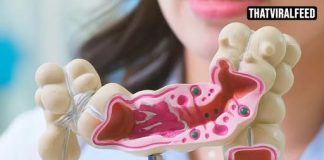 Scientists Explain Why Colon Cancer Is The Only Cancer With Rising Death Rates In People Under 50