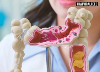 Scientists Explain Why Colon Cancer Is The Only Cancer With Rising Death Rates In People Under 50