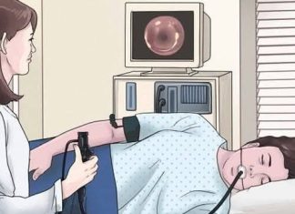 THE MOST IMPORTANT THING TO DISCUSS BEFORE YOUR COLONOSCOPY (THE ONE QUESTION THAT COULD SAVE YOUR LIFE)