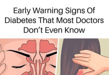 9 SUBTLE SIGNS OF DIABETES YOU MIGHT BE OVERLOOKING