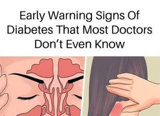 9 SUBTLE SIGNS OF DIABETES YOU MIGHT BE OVERLOOKING