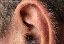 What Your Ear Hair Says About Your Health