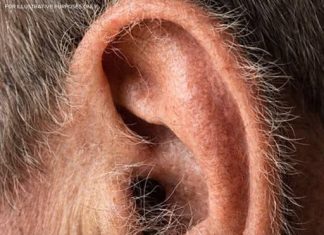 What Your Ear Hair Says About Your Health