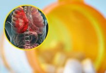 Doctor Warns Popular Medication May Lead to Organ Failure