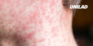 Urgent warning for US disease which just surpassed 2,000 cases for first time in 30 years