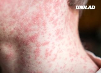 Urgent warning for US disease which just surpassed 2,000 cases for first time in 30 years