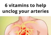 6 Vitamins to Unclog Your Arteries