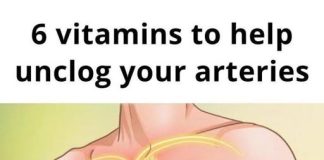 6 Vitamins to Unclog Your Arteries