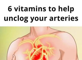 6 Vitamins to Unclog Your Arteries