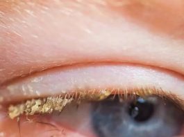 WAKE-UP MYSTERY: PEOPLE STUNNED TO LEARN WHAT THE YELLOW SUBSTANCE IN YOUR EYES ACTUALLY IS