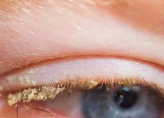 WAKE-UP MYSTERY: PEOPLE STUNNED TO LEARN WHAT THE YELLOW SUBSTANCE IN YOUR EYES ACTUALLY IS