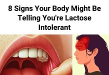 (THE HIDDEN SIGN) 10 SURPRISING SYMPTOMS OF LACTOSE INTOLERANCE THAT MOST PEOPLE SIMPLY IGNORE