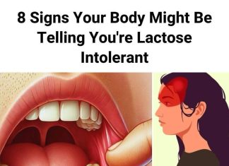 (THE HIDDEN SIGN) 10 SURPRISING SYMPTOMS OF LACTOSE INTOLERANCE THAT MOST PEOPLE SIMPLY IGNORE