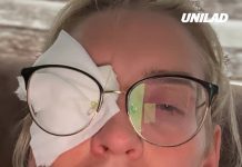 Woman went blind after making ‘stupid’ mistake while using contact lenses