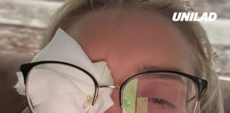 Woman went blind after making ‘stupid’ mistake while using contact lenses