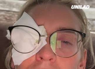Woman went blind after making ‘stupid’ mistake while using contact lenses