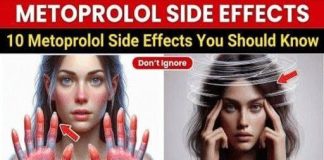 The 10 Metoprolol Side Effects Often Overlooked in Conversations