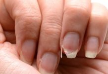 Brittle Nails? 10 Hidden Causes Your Body Is Desperately Trying to Tell You About – And How to Fix Them Fast