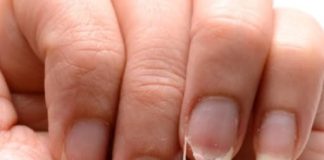 Brittle Nails? 10 Hidden Causes Your Body Is Desperately Trying to Tell You About – And How to Fix Them Fast