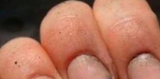 What do you call a person who has nails like that?