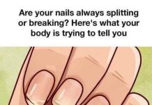 THE 7 CRITICAL HEALTH WARNINGS HIDDEN ON YOUR FINGERNAILS (WHY YOUR DOCTOR ALWAYS LOOKS AT YOUR HANDS AND WHAT THOSE STRANGE RIDGES ACTUALLY MEAN)