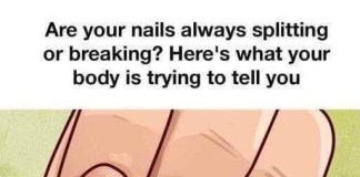 THE 7 CRITICAL HEALTH WARNINGS HIDDEN ON YOUR FINGERNAILS (WHY YOUR DOCTOR ALWAYS LOOKS AT YOUR HANDS AND WHAT THOSE STRANGE RIDGES ACTUALLY MEAN)