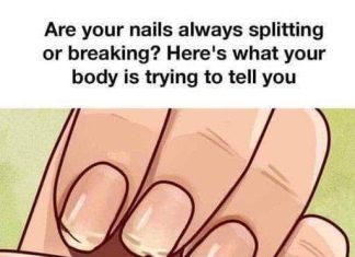 THE 7 CRITICAL HEALTH WARNINGS HIDDEN ON YOUR FINGERNAILS (WHY YOUR DOCTOR ALWAYS LOOKS AT YOUR HANDS AND WHAT THOSE STRANGE RIDGES ACTUALLY MEAN)