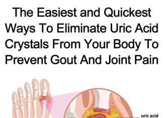 THE NATURAL CURE: EFFECTIVE WAYS TO NATURALLY RELIEVE GOUT AND SOOTHE CHRONIC JOINT PAIN