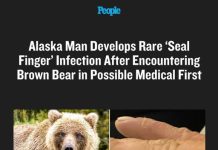 Alaska Man Develops Rare ‘Seal Finger’ Infection After Encountering Brown Bear in Possible Medical First