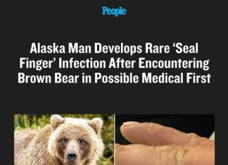 Alaska Man Develops Rare ‘Seal Finger’ Infection After Encountering Brown Bear in Possible Medical First