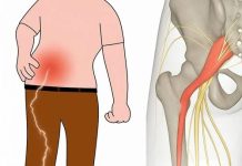 Gentle Stretches to Relieve Sciatica Pain – Safe & Effective Moves