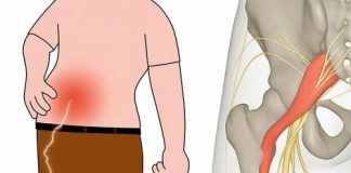 Gentle Stretches to Relieve Sciatica Pain – Safe & Effective Moves