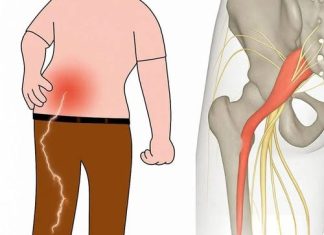 Gentle Stretches to Relieve Sciatica Pain – Safe & Effective Moves