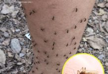 THE MOSQUITO MAGNET (WHY MOSQUITOES ALWAYS CHOOSE YOU (THE SCIENTIFIC EXPLANATION FEW KNOW))