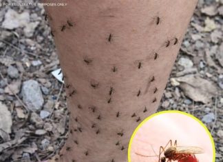 THE MOSQUITO MAGNET (WHY MOSQUITOES ALWAYS CHOOSE YOU (THE SCIENTIFIC EXPLANATION FEW KNOW))