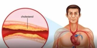 8 ARTERY-CLEANSING FOODS YOU SHOULD BE EATING EVERY DAY FOR A HEALTHY HEART