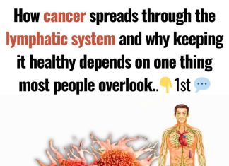 How Cancer Spreads Through the Lymphatic System (and How to Support Its Health)