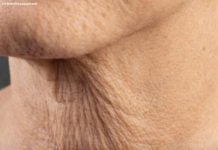 Why Neck Skin Sags as You Age — And What You Can Do About It