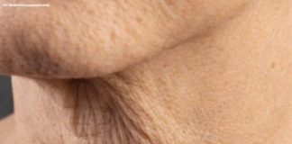 Why Neck Skin Sags as You Age — And What You Can Do About It