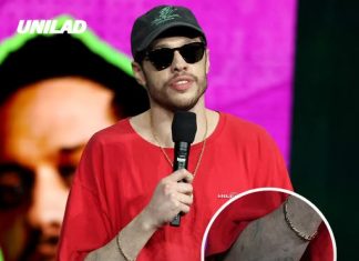 Tattoo removal explained as Pete Davidson shows bare arms after $200,000 procedure