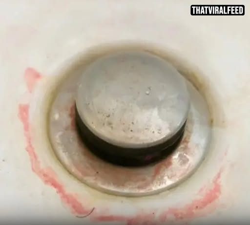 Doctor Issues Urgent Warning To Anyone Finding ‘Pink Slime’ In Their Bathroom