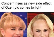 THE UNEXPECTED DENTAL TOLL OF WEIGHT LOSS MEDS (WHAT YOU NEED TO KNOW ABOUT THE RISING ‘OZEMPIC MOUTH’ SIDE EFFECT)