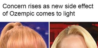 THE UNEXPECTED DENTAL TOLL OF WEIGHT LOSS MEDS (WHAT YOU NEED TO KNOW ABOUT THE RISING ‘OZEMPIC MOUTH’ SIDE EFFECT)