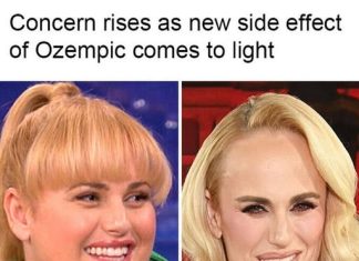 THE UNEXPECTED DENTAL TOLL OF WEIGHT LOSS MEDS (WHAT YOU NEED TO KNOW ABOUT THE RISING ‘OZEMPIC MOUTH’ SIDE EFFECT)