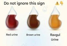 What does the color of your urine say about your health?