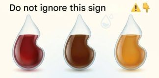 What does the color of your urine say about your health?