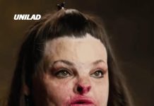 Former addict given just 5% chance to live after setting herself on fire explains how she finally got sober