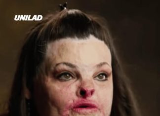 Former addict given just 5% chance to live after setting herself on fire explains how she finally got sober